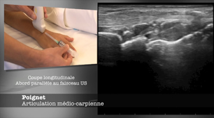 ENSEIGNEMENT GESTES ECHO-32