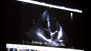 Hydratation, APS et système cardiovasculaire : Dr. Stéphane DOUTRELEAU