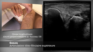 ENSEIGNEMENT GESTES ECHO-52