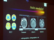 Imagerie chirurgicale : la précision de l'ordinateur (J. Troccaz) - 2001