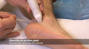 ENSEIGNEMENT GESTES ECHO-59