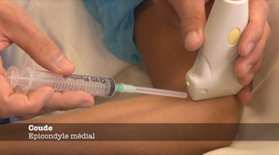 ENSEIGNEMENT GESTES ECHO-21