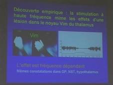 Chirurgie du cerveau (P. Pollack) - 2003