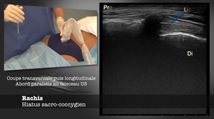 ENSEIGNEMENT GESTES ECHO-42
