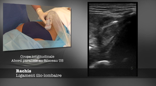 ENSEIGNEMENT GESTES ECHO-44