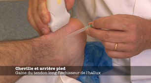 ENSEIGNEMENT GESTES ECHO-61