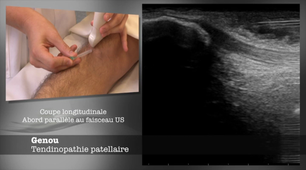 ENSEIGNEMENT GESTES ECHO-54